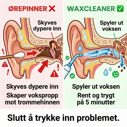 Waxcleaner – Enkel og effektiv ørerens på bare 5 minutter